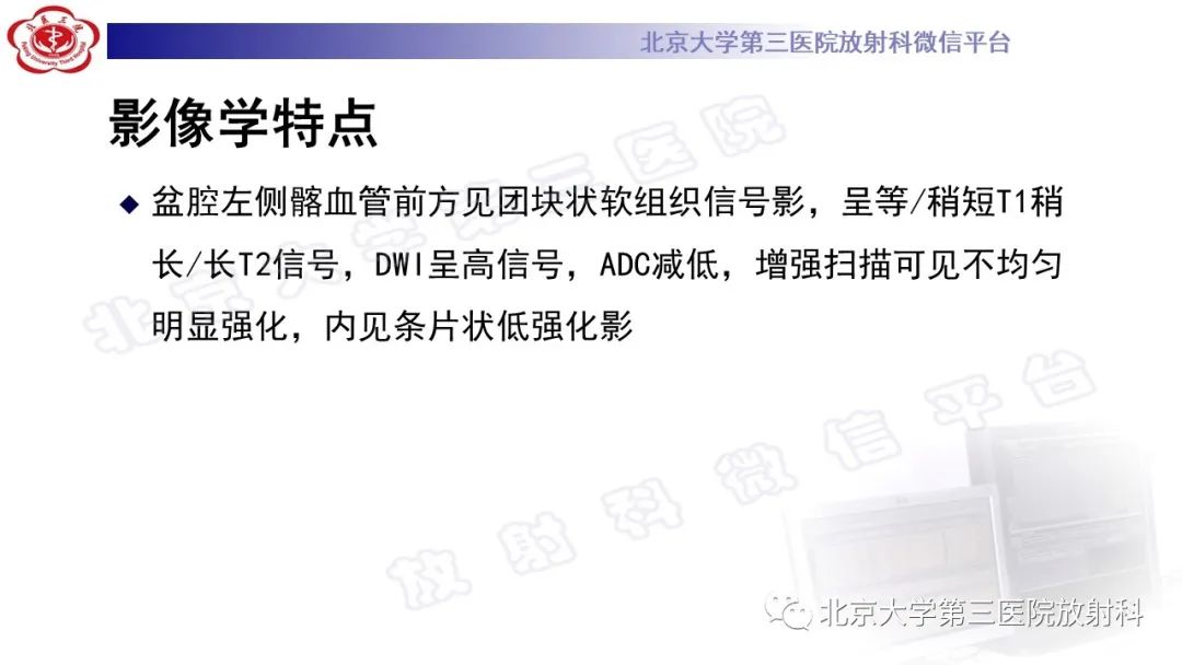 影像PPT - 【PPT】精原细胞瘤-8