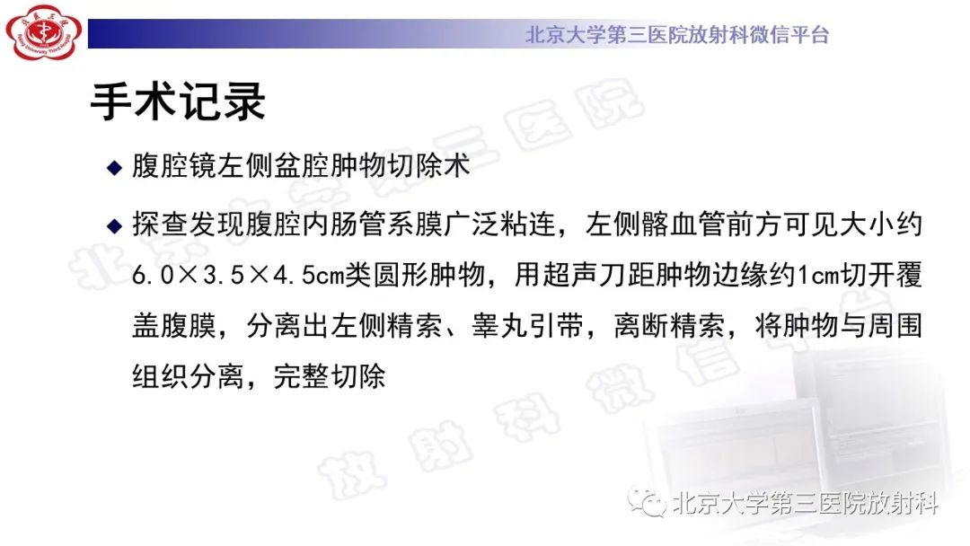 影像PPT - 【PPT】精原细胞瘤-10