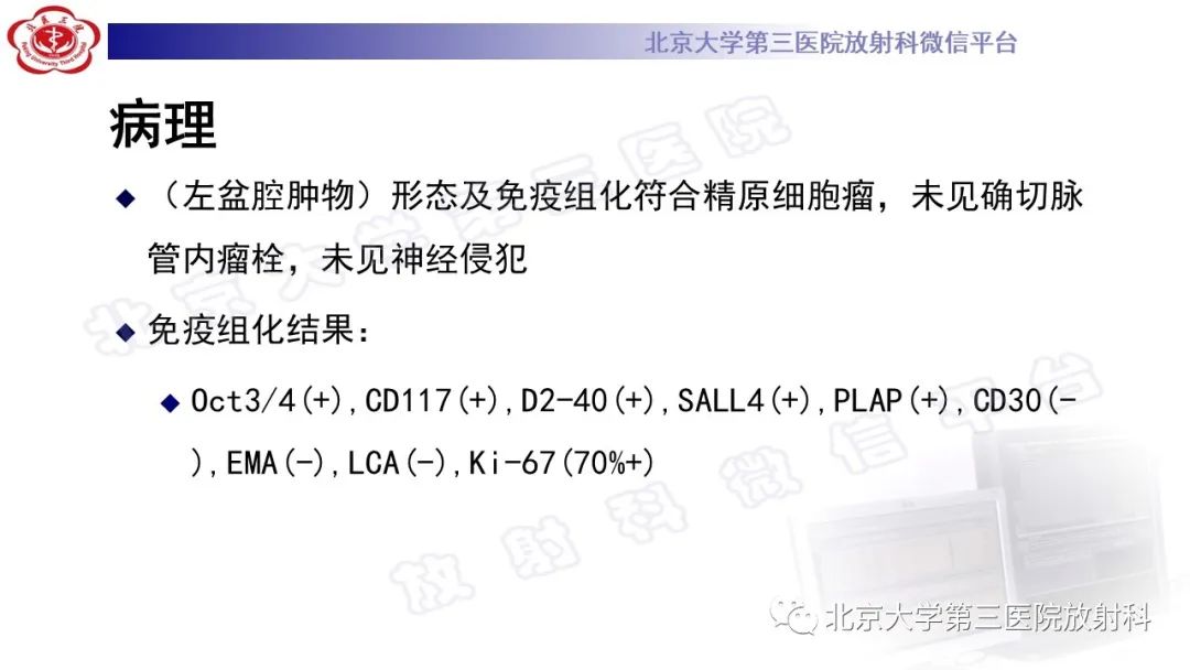 影像PPT - 【PPT】精原细胞瘤-11