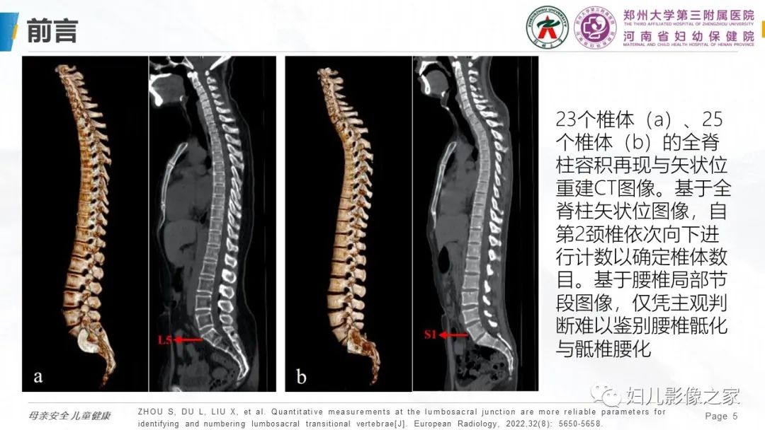 影像PPT - 【PPT】椎体定位与计数—再认识-4