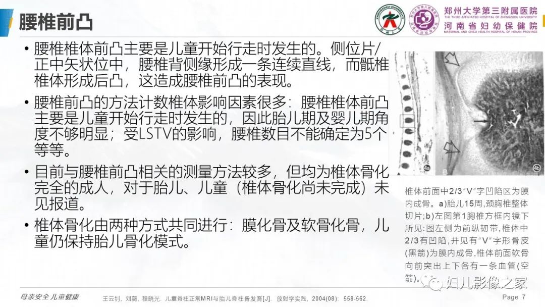 影像PPT - 【PPT】椎体定位与计数—再认识-6