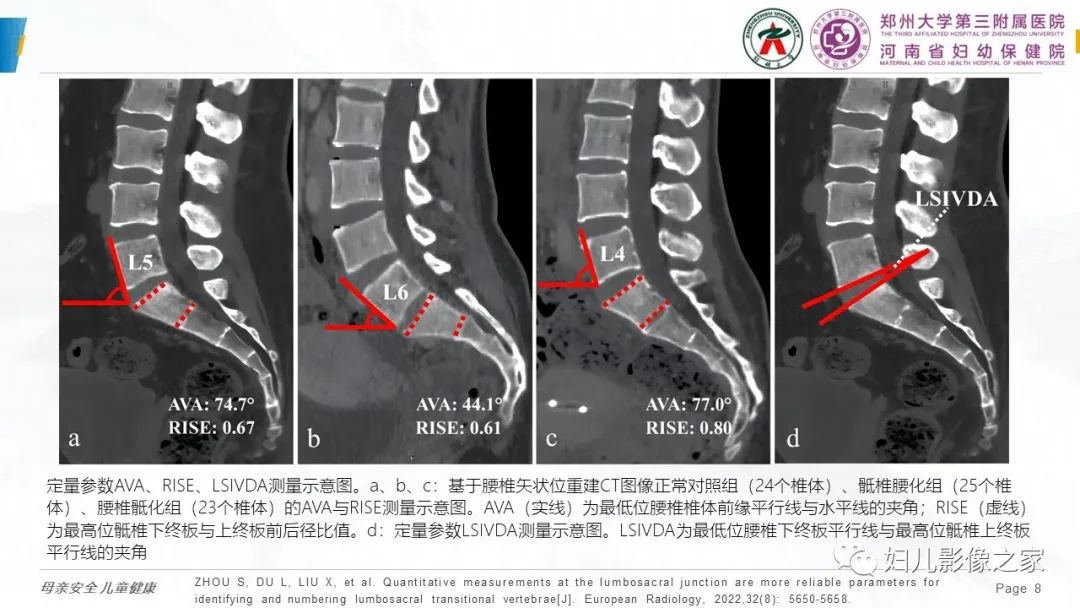 影像PPT - 【PPT】椎体定位与计数—再认识-7