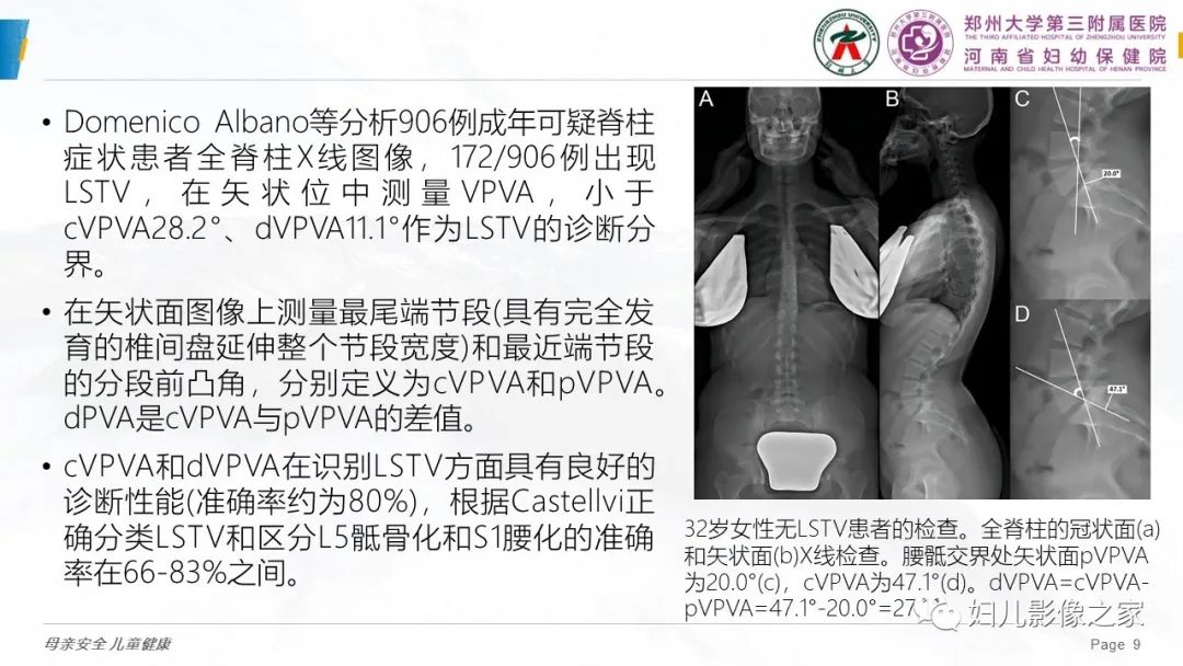 影像PPT - 【PPT】椎体定位与计数—再认识-8