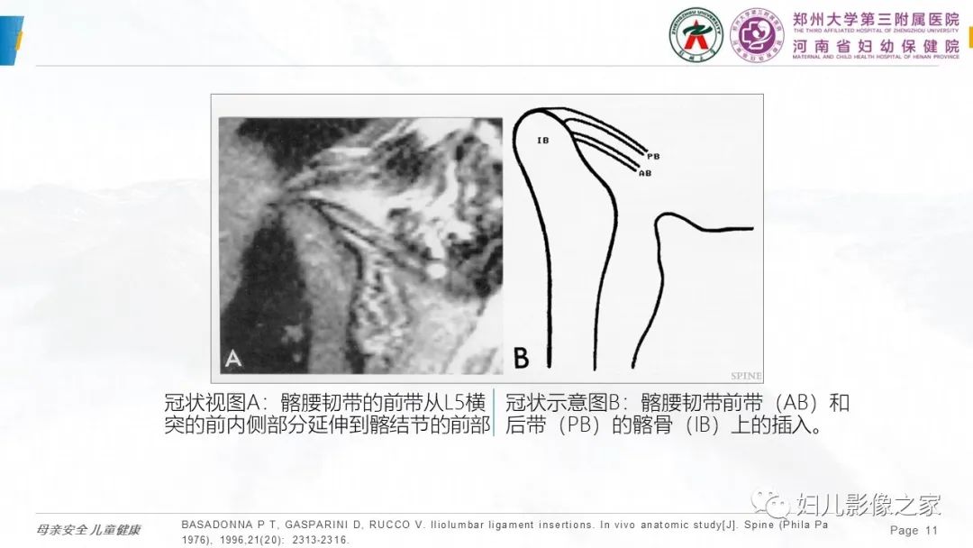 影像PPT - 【PPT】椎体定位与计数—再认识-10