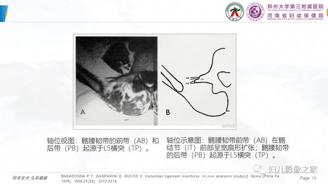 影像PPT - 【PPT】椎体定位与计数—再认识-11