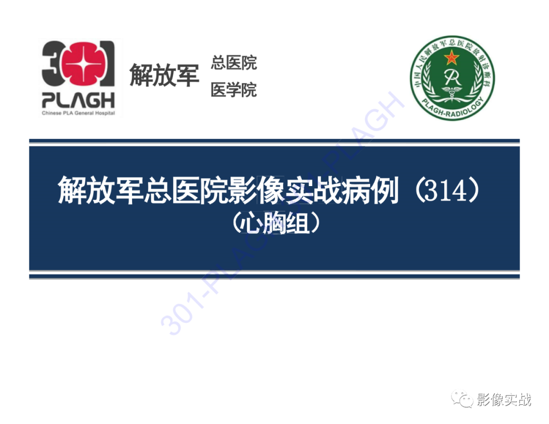 影像PPT - 【病例】前纵隔畸胎瘤1例CT影像-1