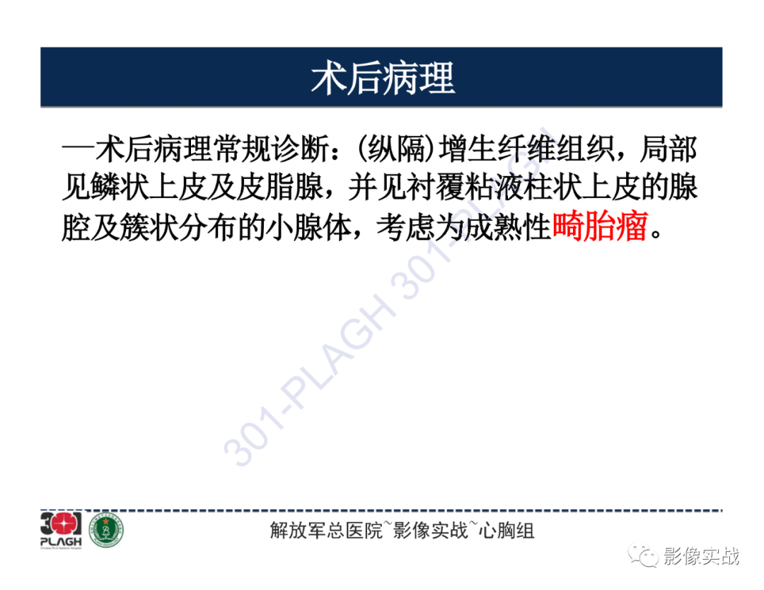 影像PPT - 【病例】前纵隔畸胎瘤1例CT影像-15