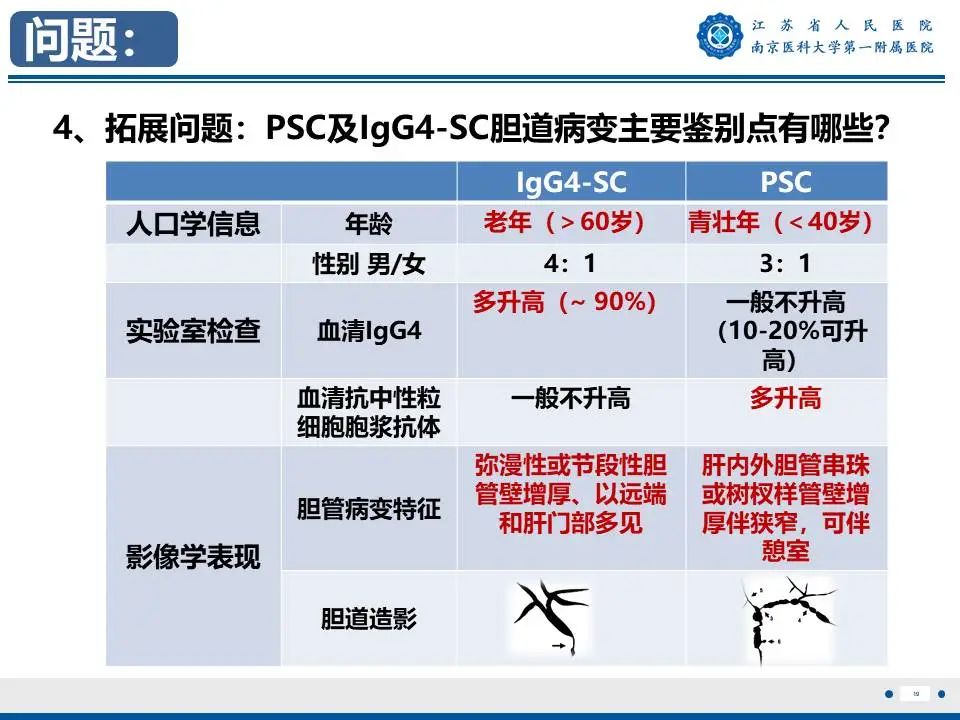 影像PPT - 【PPT】IgG4相关性硬化性胆管炎-20