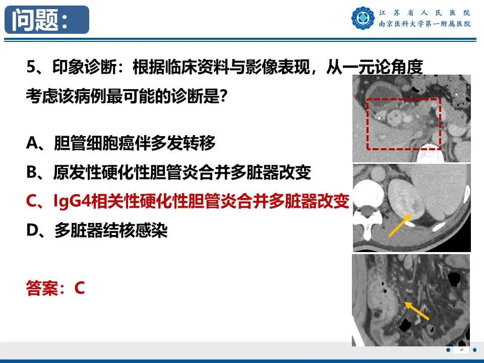影像PPT - 【PPT】IgG4相关性硬化性胆管炎-28