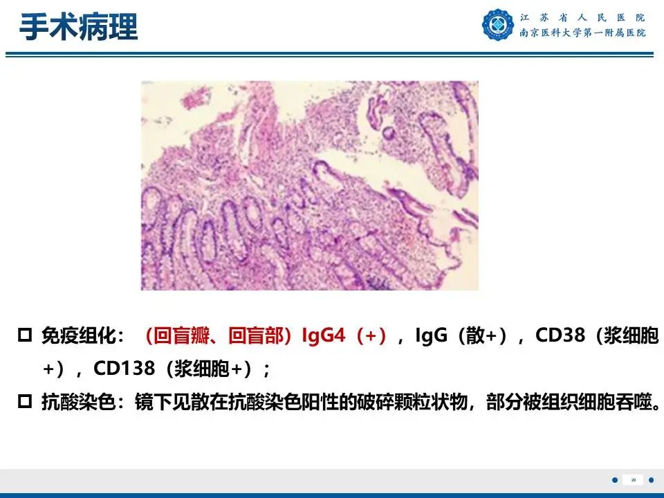 影像PPT - 【PPT】IgG4相关性硬化性胆管炎-30