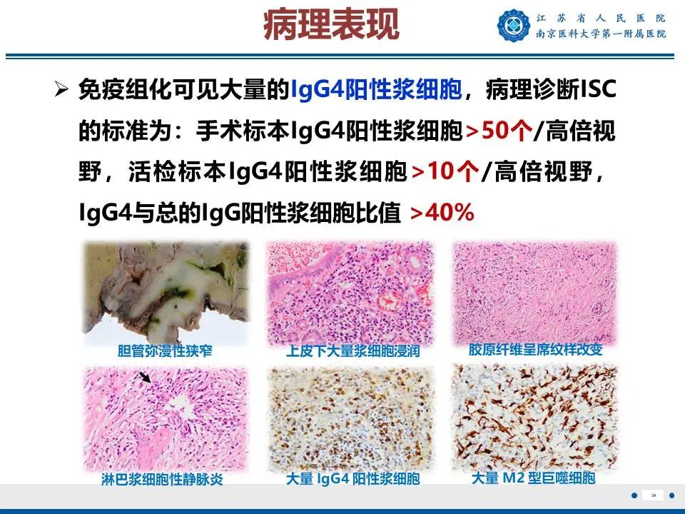 影像PPT - 【PPT】IgG4相关性硬化性胆管炎-35