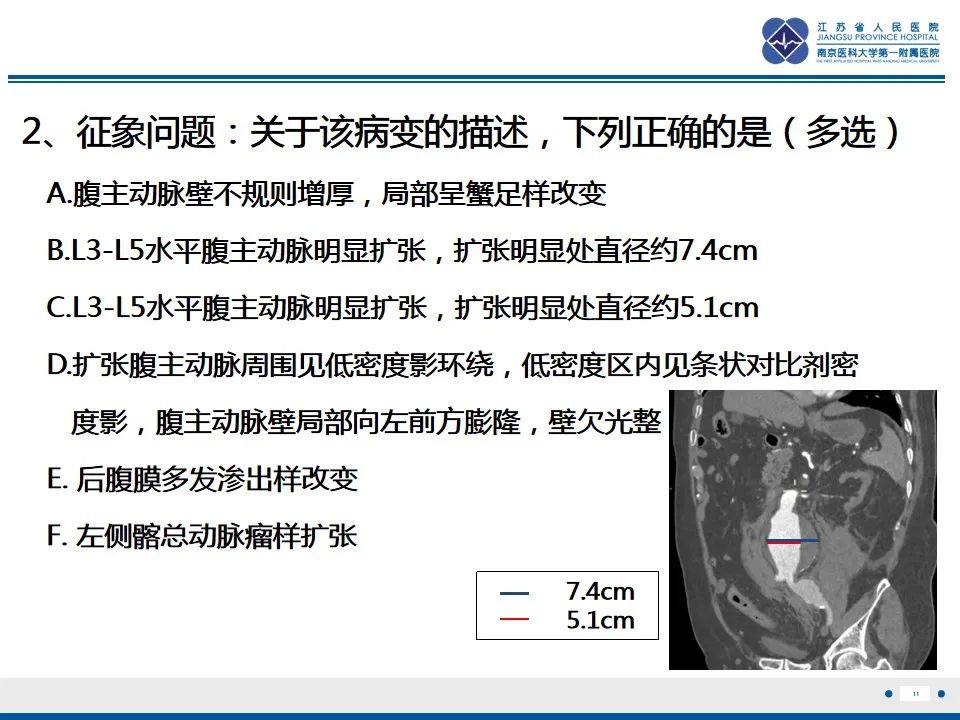 影像PPT - 高度危险的“高密度新月征”-13 影像PPT - 高度危险的“高密度新月征”-13
