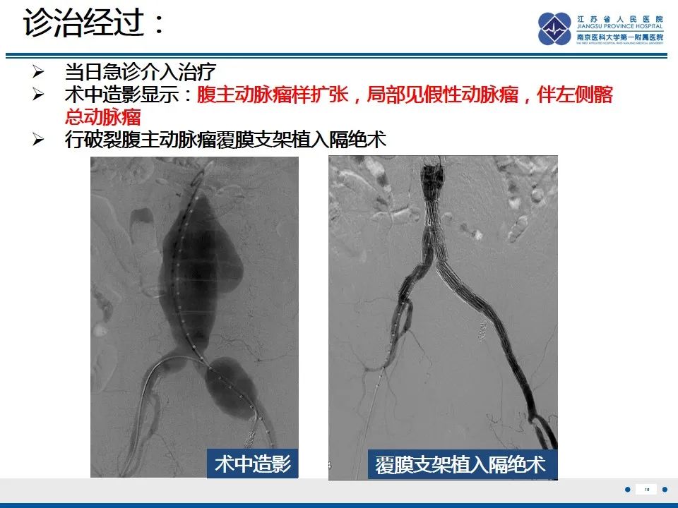 影像PPT - 高度危险的“高密度新月征”-17 影像PPT - 高度危险的“高密度新月征”-17