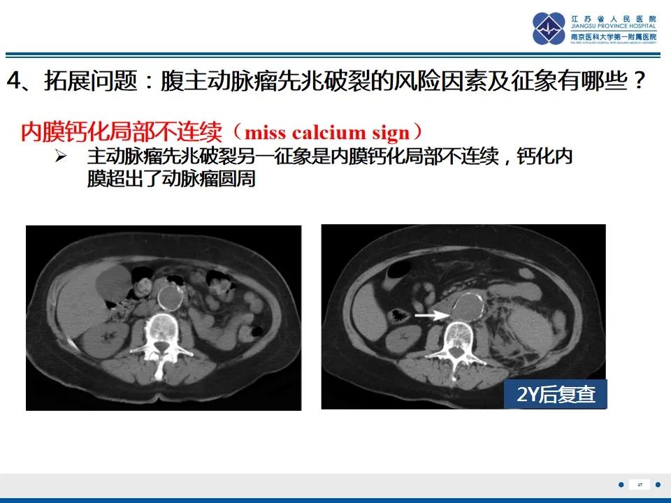 影像PPT - 高度危险的“高密度新月征”-29 影像PPT - 高度危险的“高密度新月征”-29