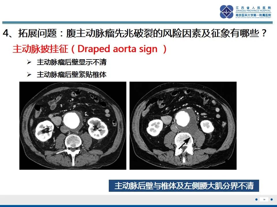 影像PPT - 高度危险的“高密度新月征”-32 影像PPT - 高度危险的“高密度新月征”-32