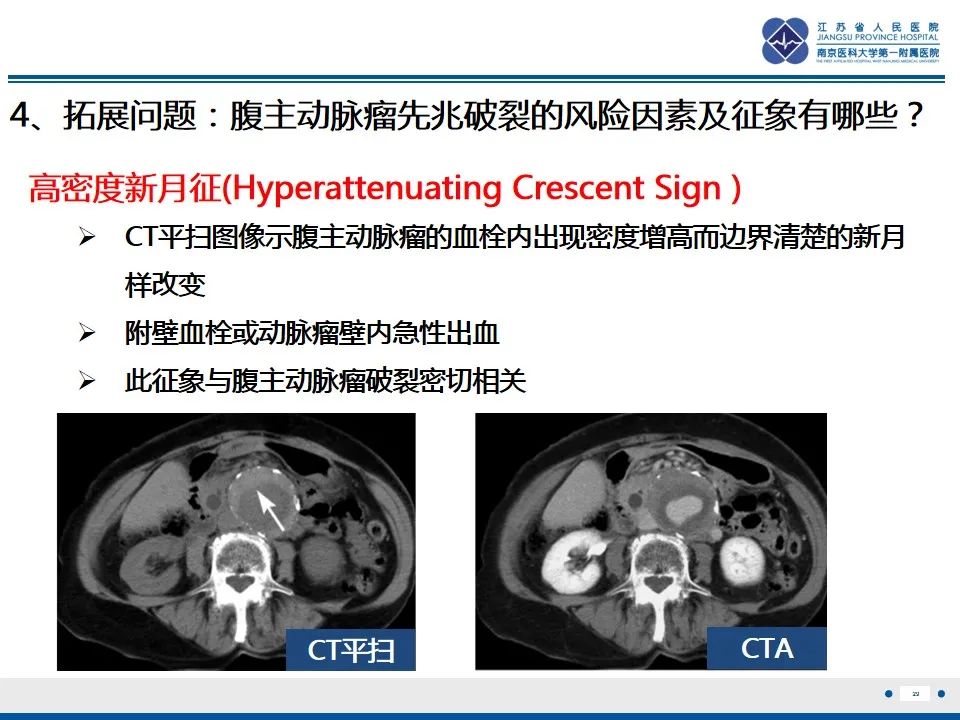 影像PPT - 高度危险的“高密度新月征”-31 影像PPT - 高度危险的“高密度新月征”-31