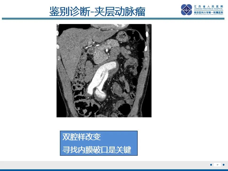 影像PPT - 高度危险的“高密度新月征”-39 影像PPT - 高度危险的“高密度新月征”-39