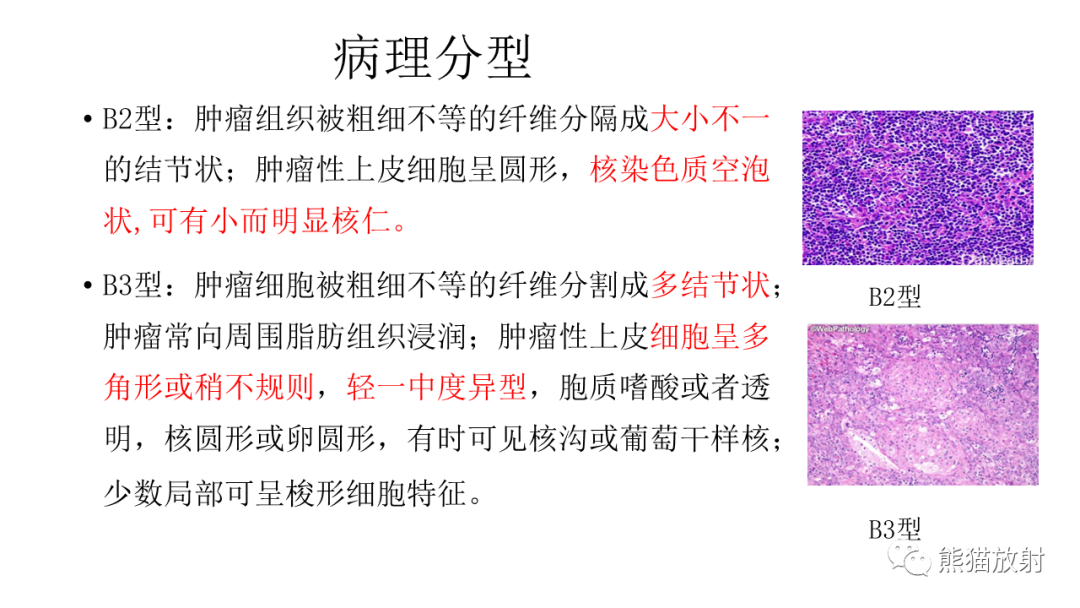 影像PPT - 【病例】胸腺瘤 VS 淋巴瘤-15