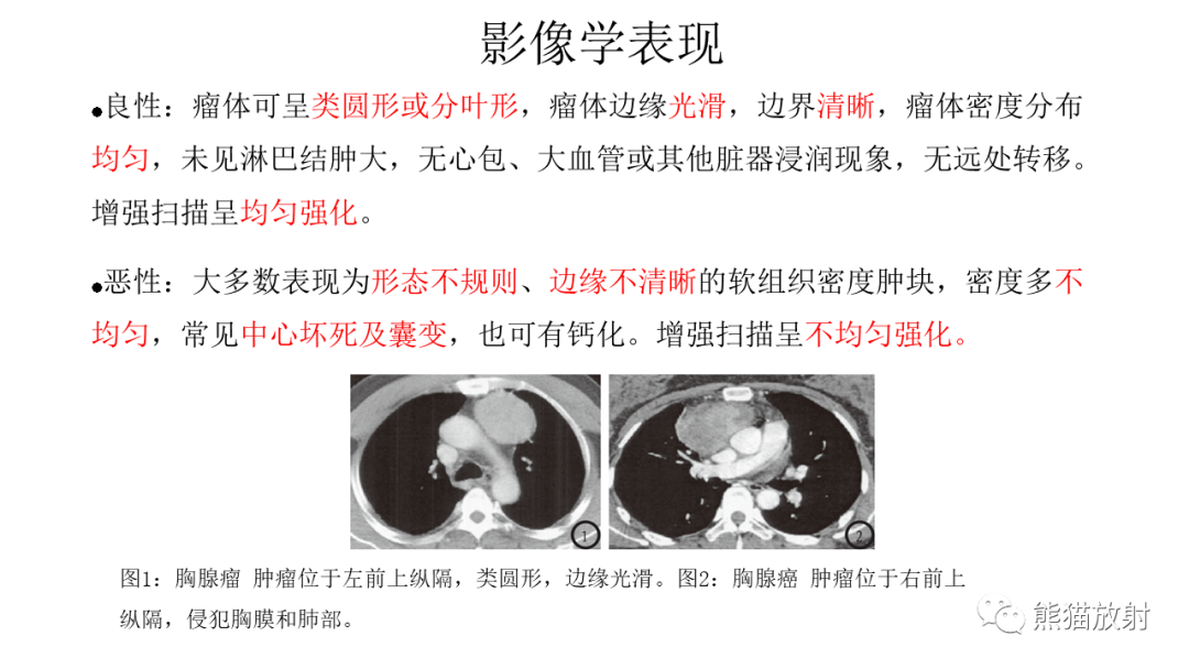 影像PPT - 【病例】胸腺瘤 VS 淋巴瘤-17