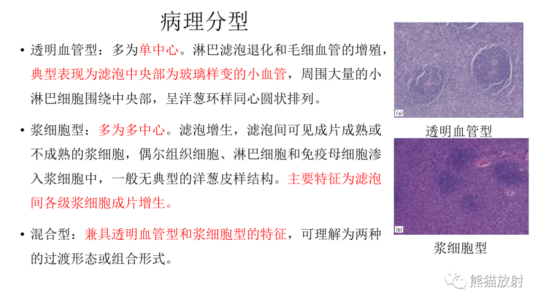 影像PPT - 【病例】胸腺瘤 VS 淋巴瘤-24