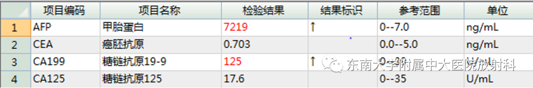 影像PPT - 【PPT】伴胆管扩张的肝内占位-5 影像PPT - 【PPT】伴胆管扩张的肝内占位-5