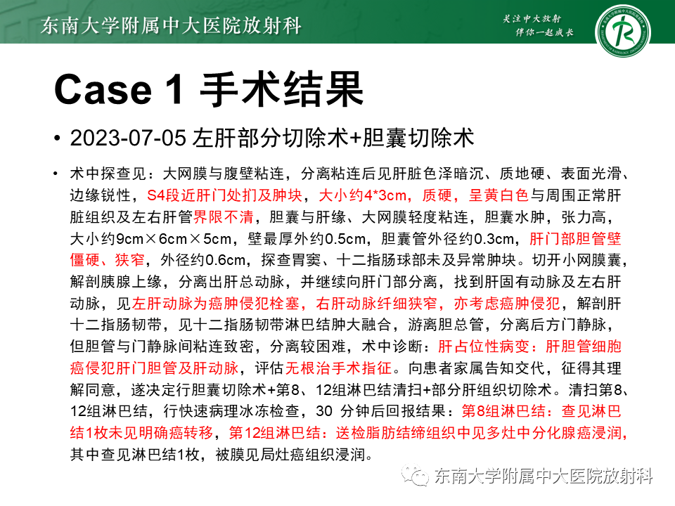 影像PPT - 【PPT】伴胆管扩张的肝内占位-14 影像PPT - 【PPT】伴胆管扩张的肝内占位-14