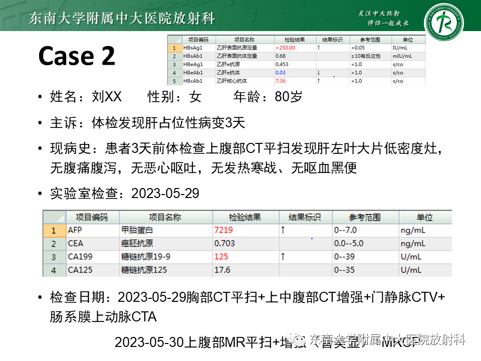 影像PPT - 【PPT】伴胆管扩张的肝内占位-17 影像PPT - 【PPT】伴胆管扩张的肝内占位-17
