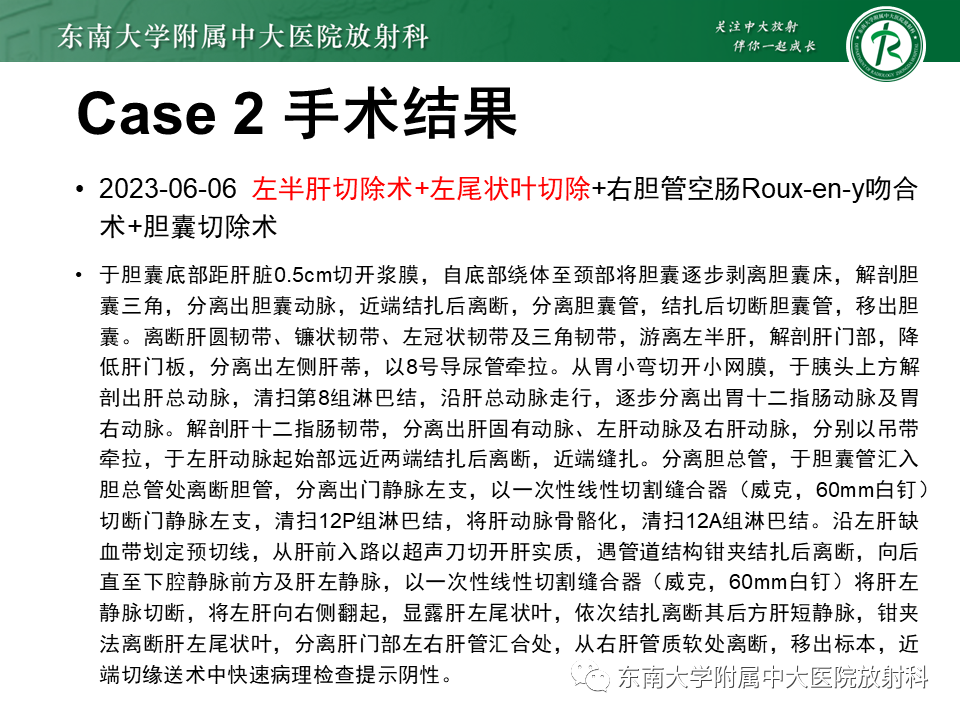 影像PPT - 【PPT】伴胆管扩张的肝内占位-20 影像PPT - 【PPT】伴胆管扩张的肝内占位-20