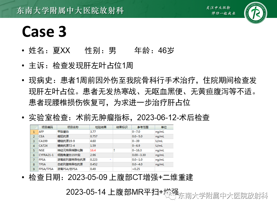 影像PPT - 【PPT】伴胆管扩张的肝内占位-23 影像PPT - 【PPT】伴胆管扩张的肝内占位-23