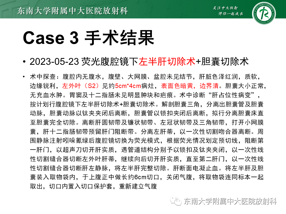 影像PPT - 【PPT】伴胆管扩张的肝内占位-26 影像PPT - 【PPT】伴胆管扩张的肝内占位-26