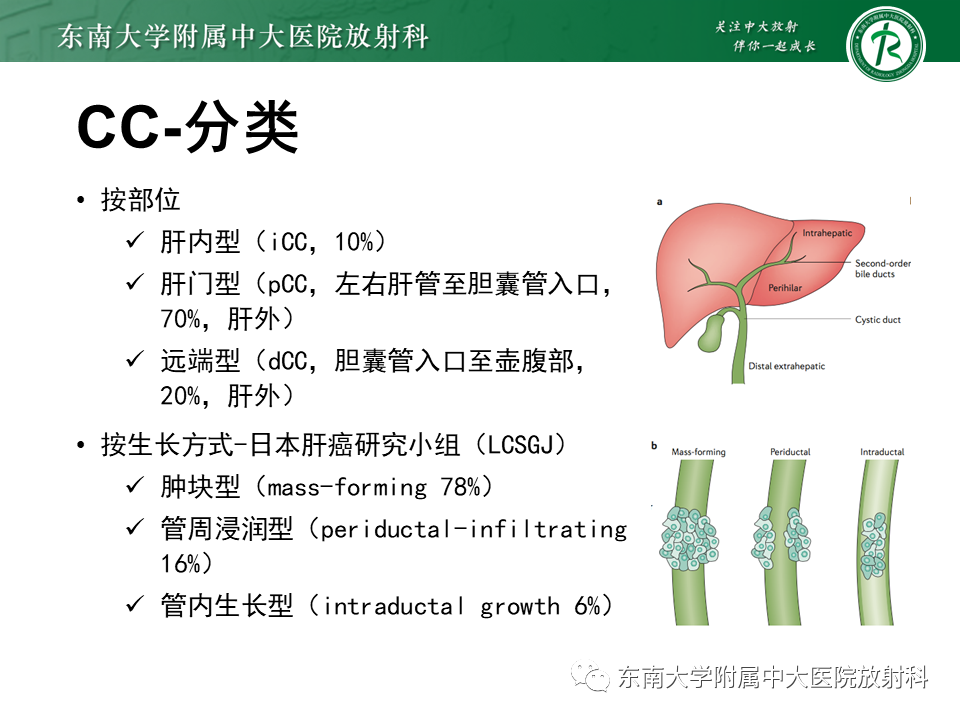 影像PPT - 【PPT】伴胆管扩张的肝内占位-31 影像PPT - 【PPT】伴胆管扩张的肝内占位-31