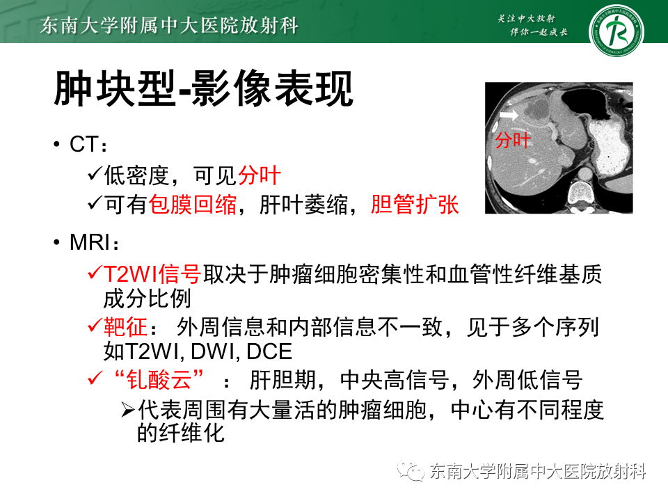 影像PPT - 【PPT】伴胆管扩张的肝内占位-36 影像PPT - 【PPT】伴胆管扩张的肝内占位-36