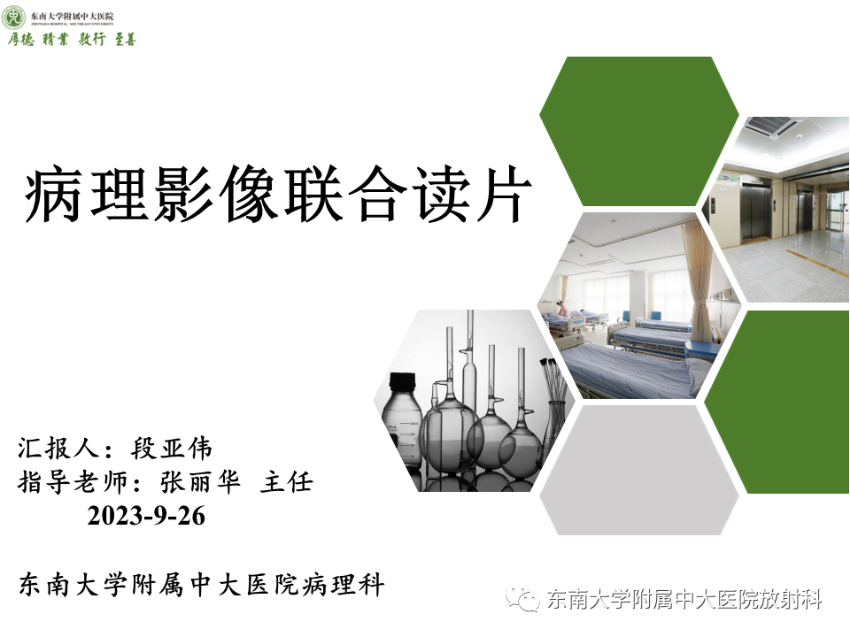 影像PPT - 【PPT】伴胆管扩张的肝内占位-43 影像PPT - 【PPT】伴胆管扩张的肝内占位-43