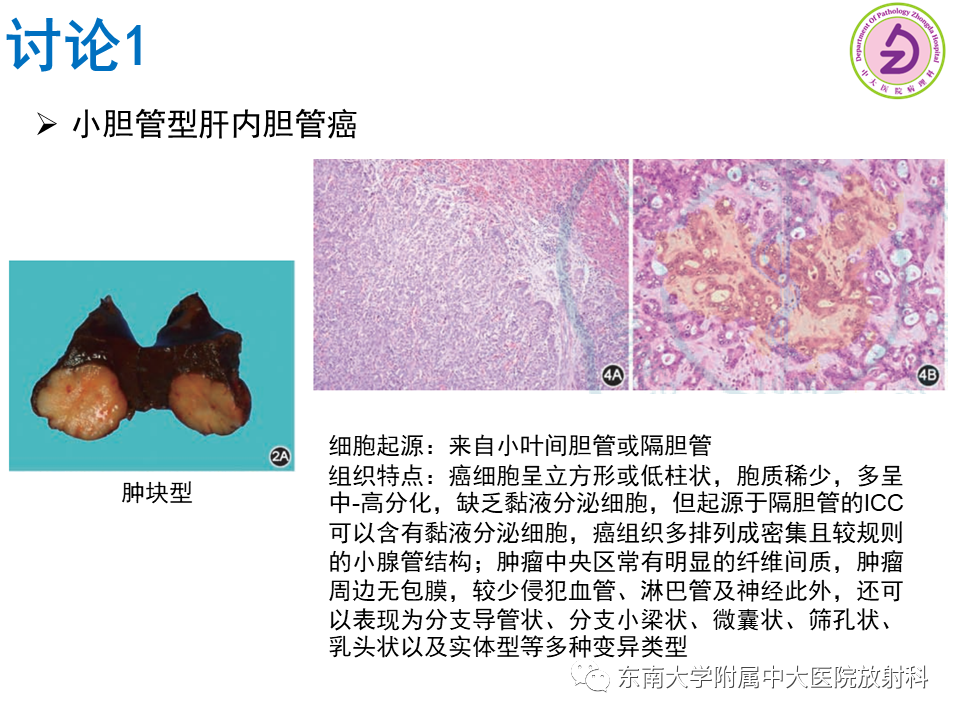 影像PPT - 【PPT】伴胆管扩张的肝内占位-50 影像PPT - 【PPT】伴胆管扩张的肝内占位-50