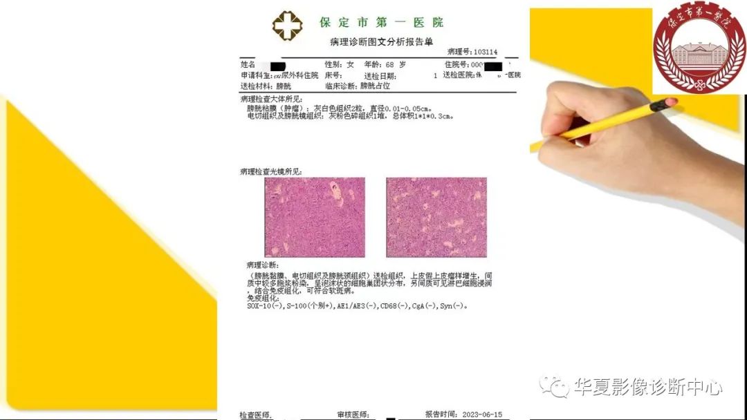 影像PPT - 【病例】膀胱软斑病1例CT及MR影像-12