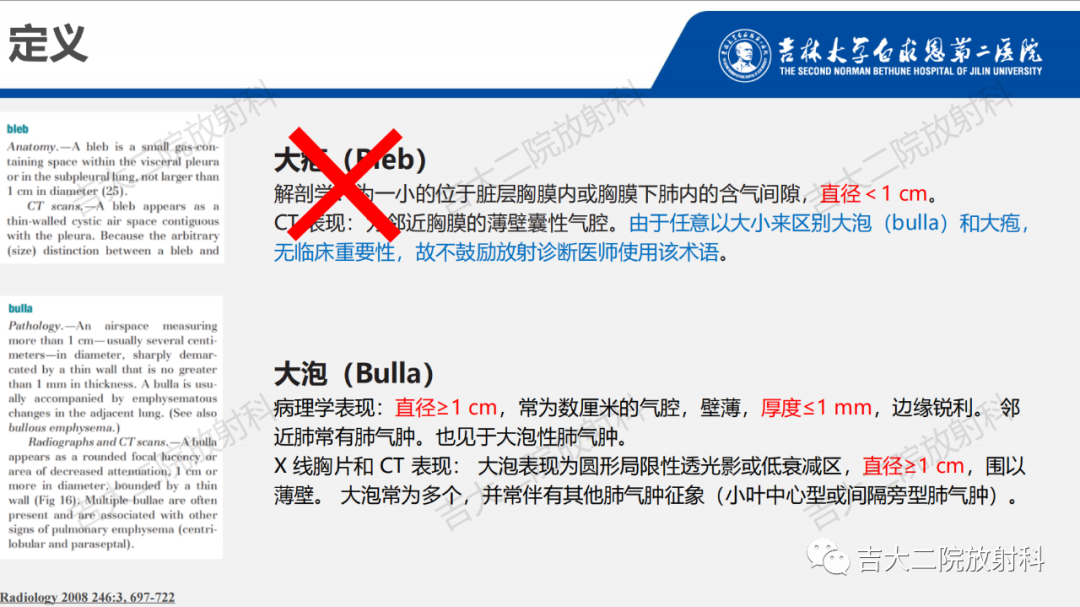 影像PPT - 【PPT】肺含气囊性病变的影像表现-4