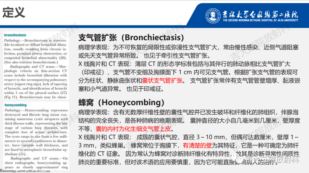 影像PPT - 【PPT】肺含气囊性病变的影像表现-6