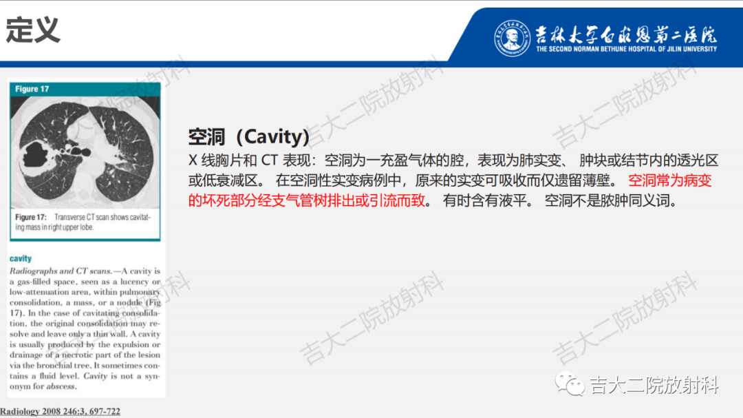 影像PPT - 【PPT】肺含气囊性病变的影像表现-7