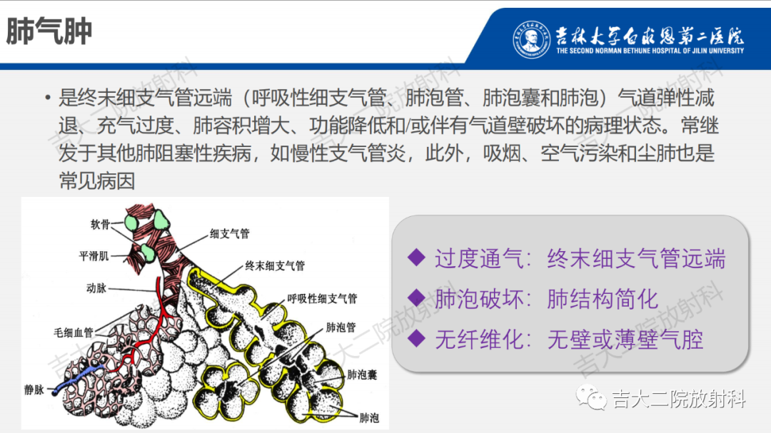 影像PPT - 【PPT】肺含气囊性病变的影像表现-9