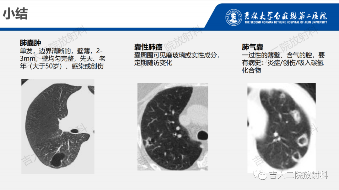 影像PPT - 【PPT】肺含气囊性病变的影像表现-34