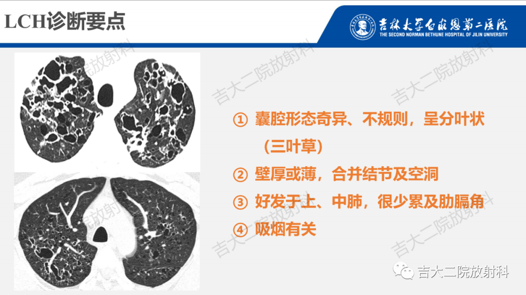 影像PPT - 【PPT】肺含气囊性病变的影像表现-49