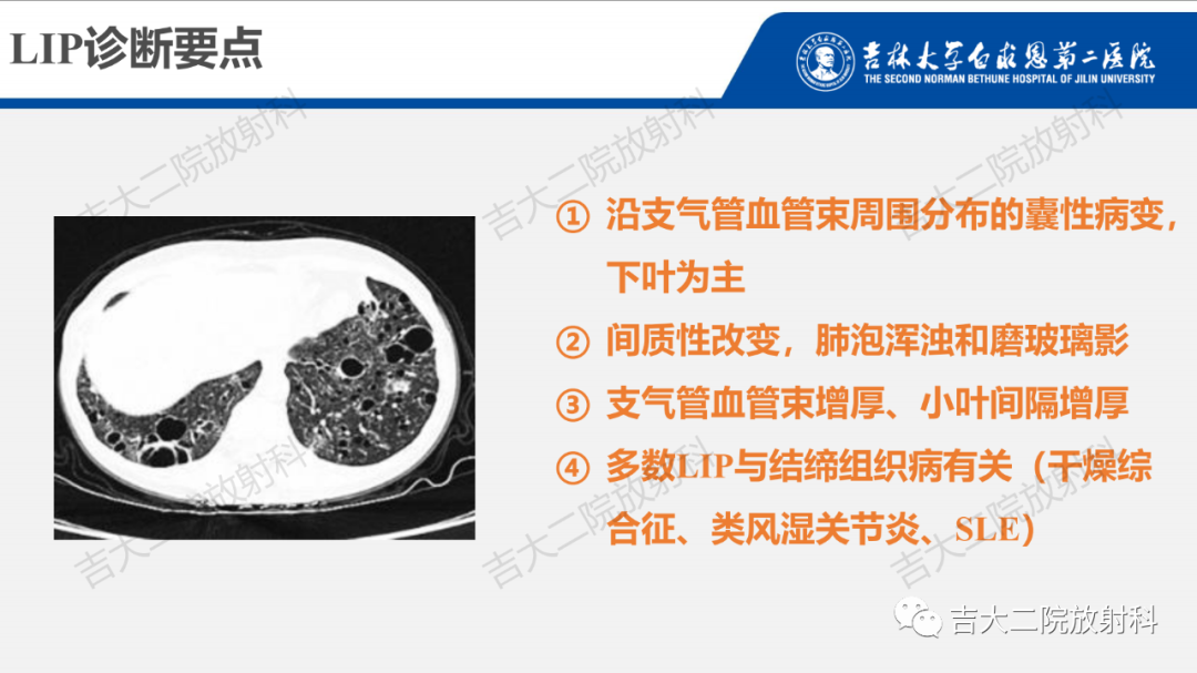 影像PPT - 【PPT】肺含气囊性病变的影像表现-53