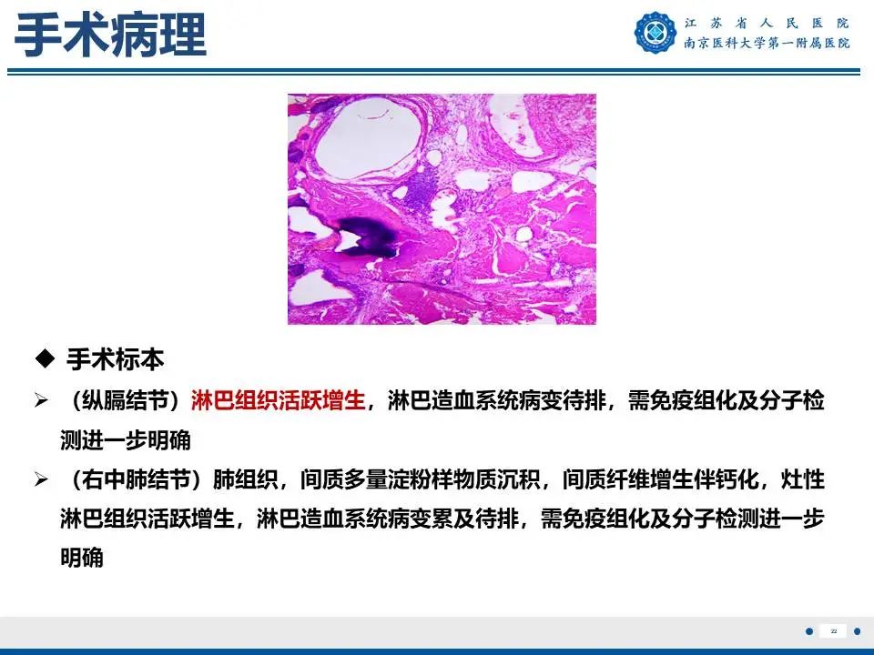 影像PPT - 【PPT】胸腺黏膜相关组织淋巴瘤-23