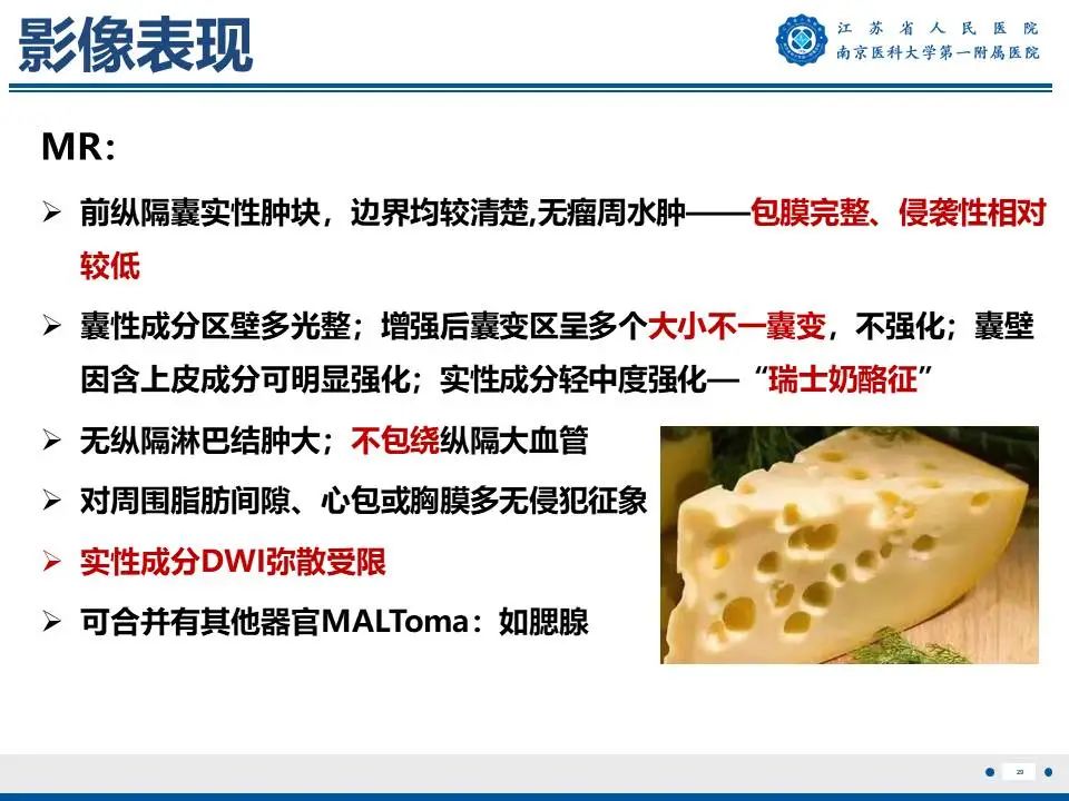 影像PPT - 【PPT】胸腺黏膜相关组织淋巴瘤-30
