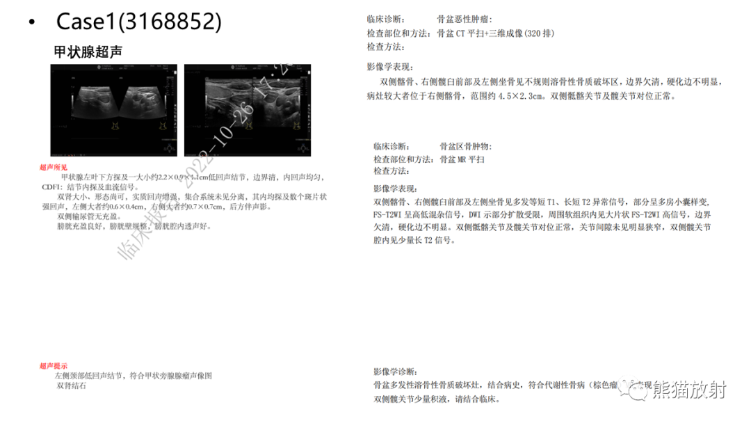 影像PPT - 【病例】髂骨棕色瘤 VS 动脉瘤样骨囊肿-14