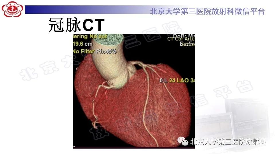 影像PPT - 【PPT】心肌桥-6