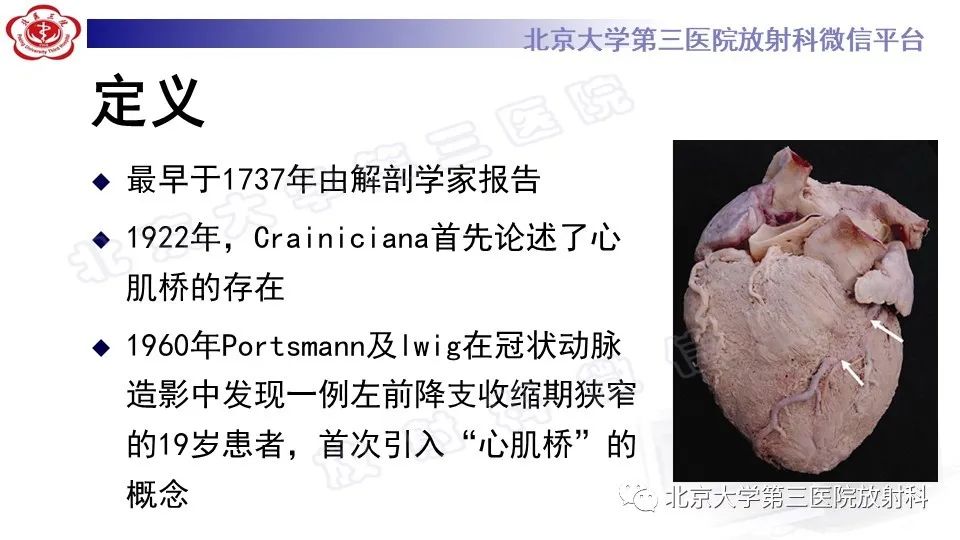 影像PPT - 【PPT】心肌桥-11