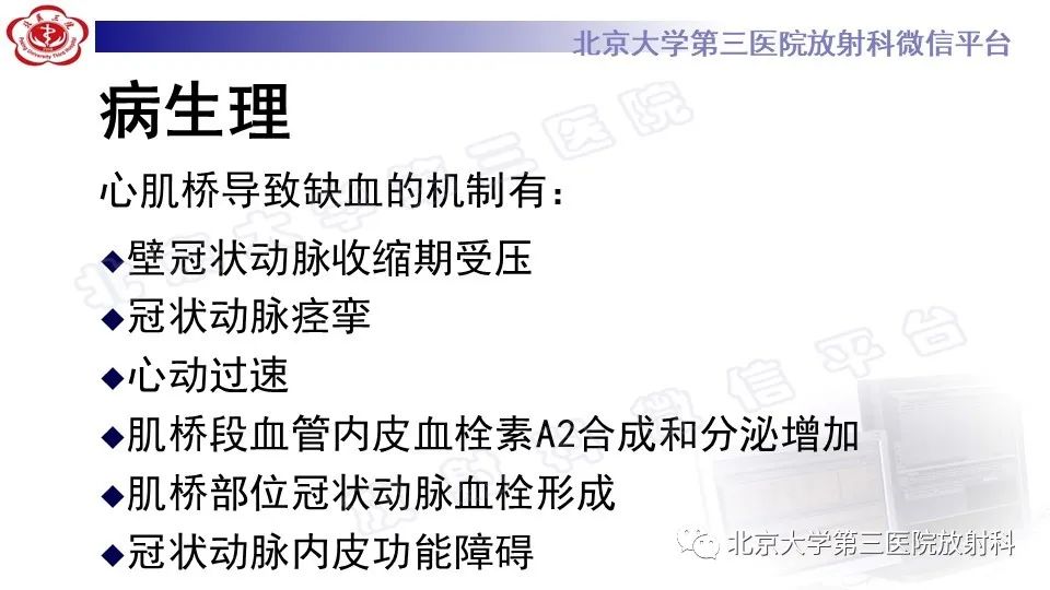 影像PPT - 【PPT】心肌桥-19