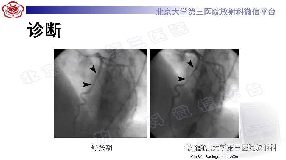 影像PPT - 【PPT】心肌桥-21