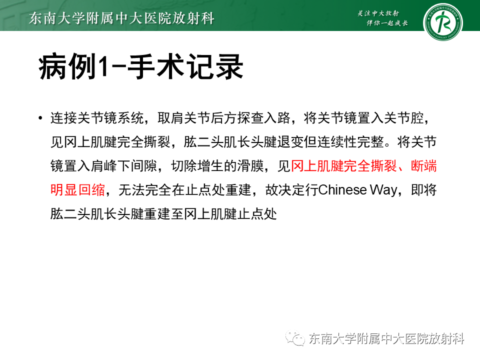 影像PPT - 【PPT】肩峰下撞击综合征-6 影像PPT - 【PPT】肩峰下撞击综合征-6